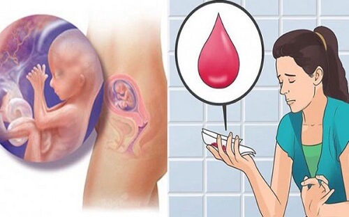 Ra máu giữa chu kỳ kinh có thai không?